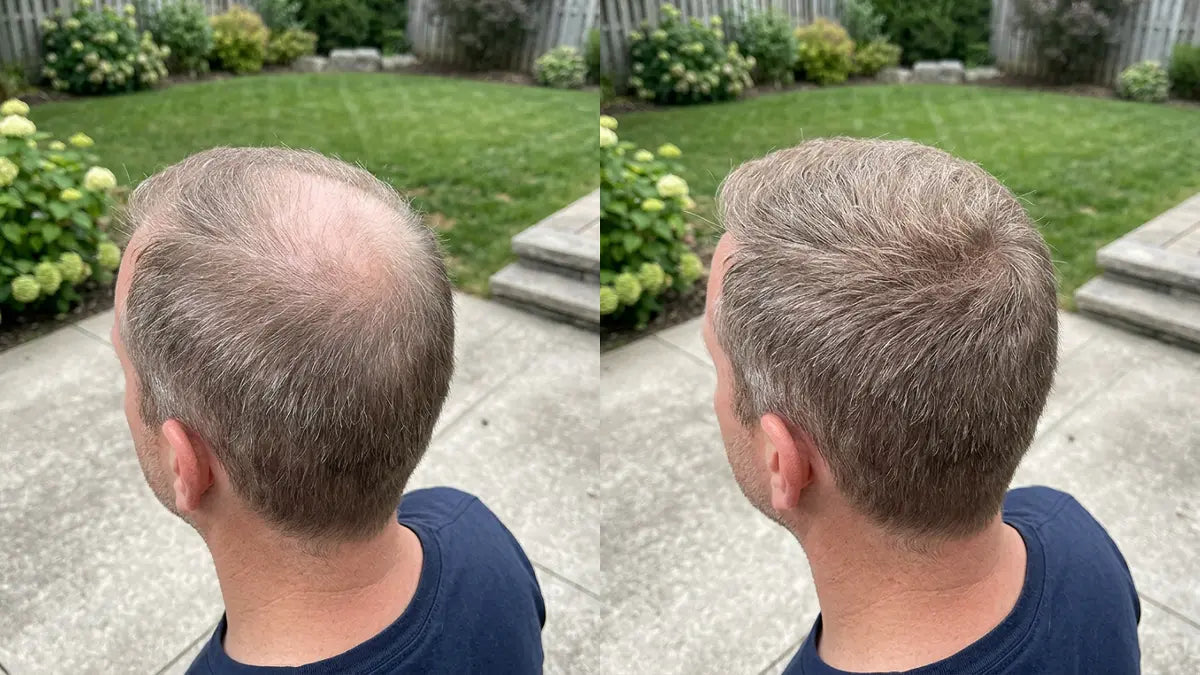 Customer before and after — back of head